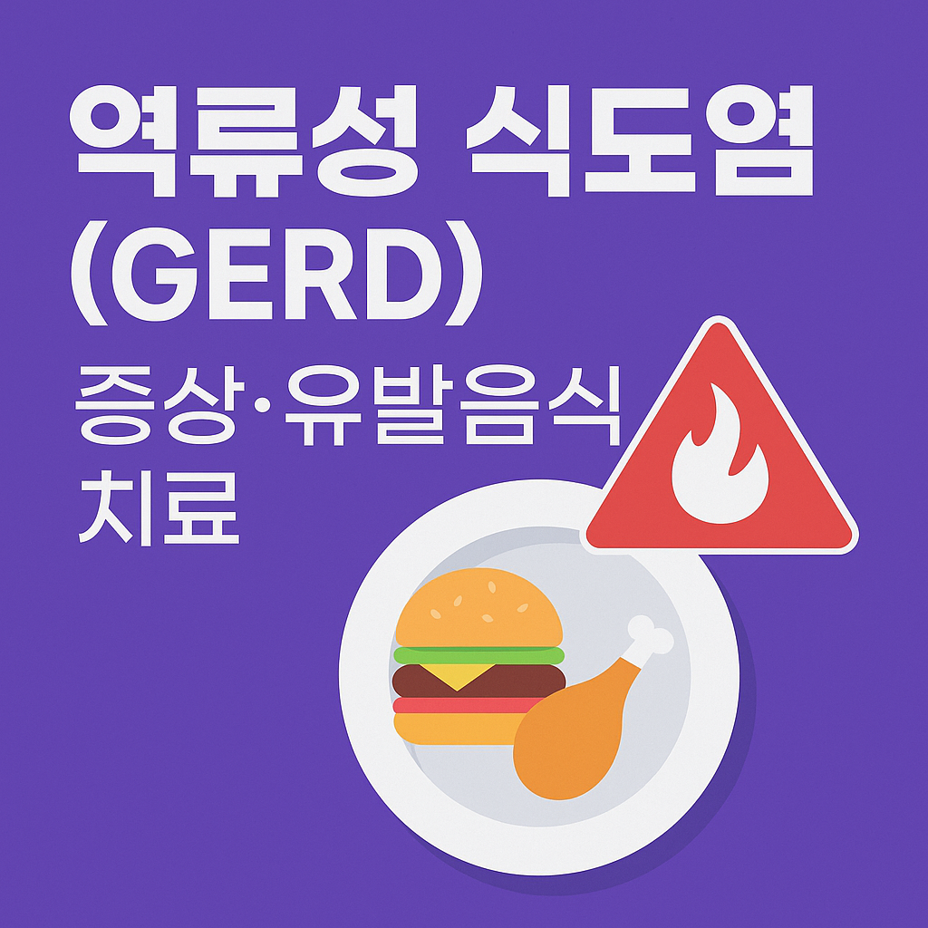 역류성 식도염(GERD): 증상·유발음식·치료