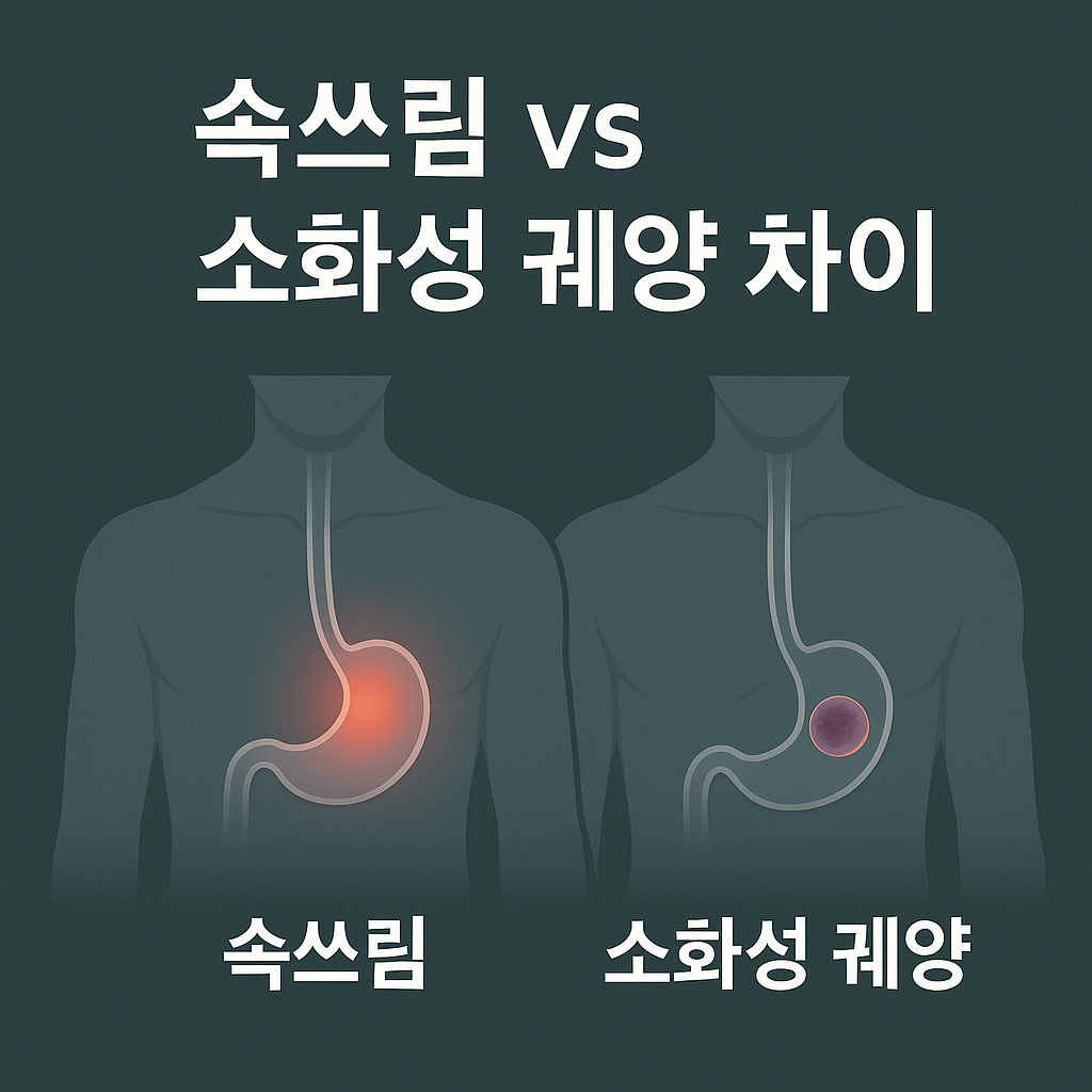 속쓰림 vs 소화성 궤양 차이