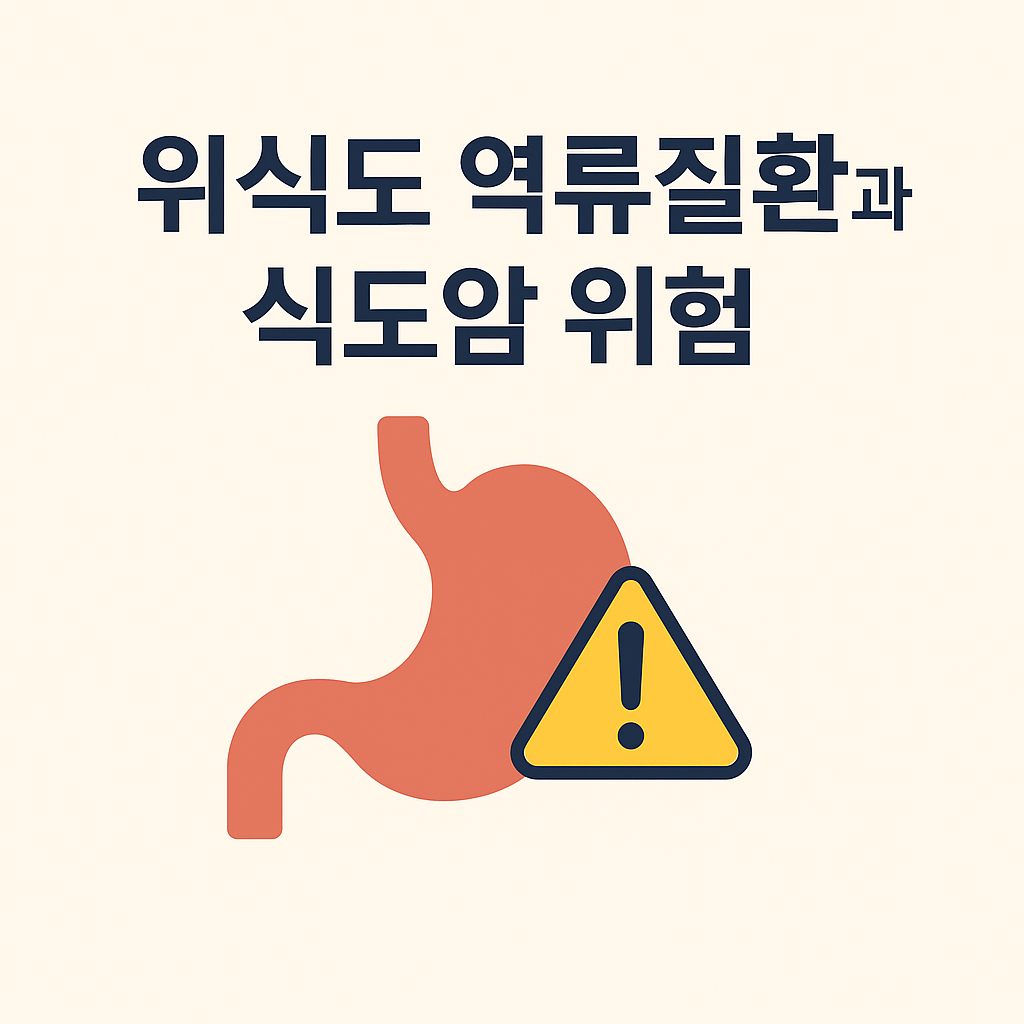 위식도 역류질환과 식도암 위험