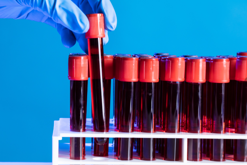 자가면역질환 진단