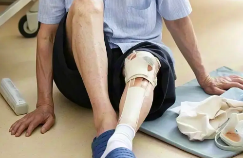 노인성 골절 치료 왜 고령층은 작은 낙상에도 위험할까?