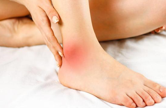 발목 염좌 등급별 치료 원칙과 재활 전략