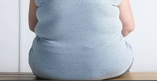 성인 비만 약물 치료부터 대사수술까지