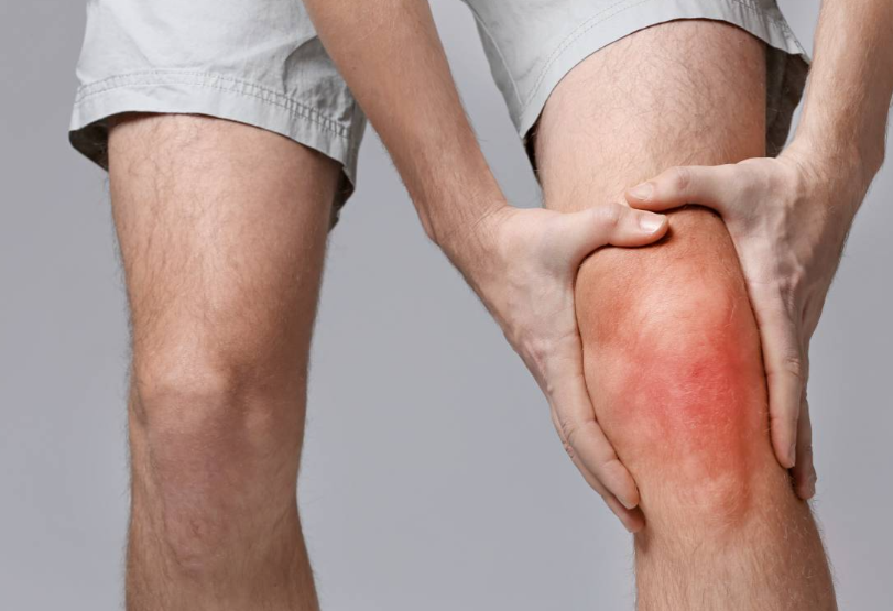 만성 통풍성 관절염 관리법과 장기 추적 관리 가이드